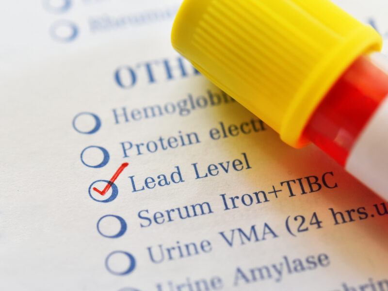 GUIDE: How Michigan’s new universal lead testing law affects your child