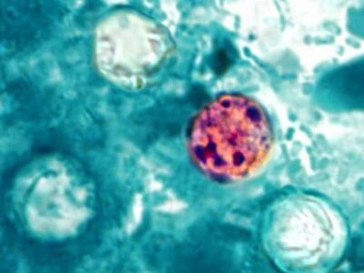 Michigan environmental news: Parasite outbreak grows, heat strains DTE grid
